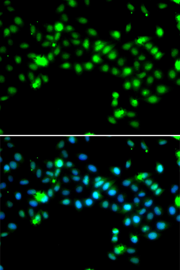 Immunofluorescence - SRSF4 Polyclonal Antibody 