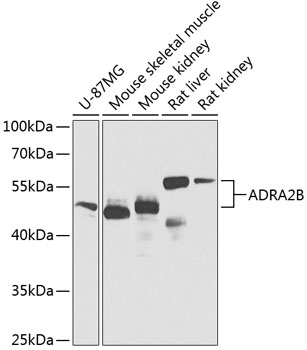 Western blot - ADRA2B Polyclonal Antibody 