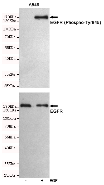 Western blot analysis of extracts from A549 cells, untreated or treated with EGF(10ng/ml,10min), using EGFR (Phospho-Tyr845) Rabbit pAb (166669,1:500 diluted,upper) and EGF Receptor Mouse mAb (201012-3F12,lower).