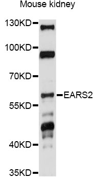 Western blot - EARS2 Polyclonal Antibody 