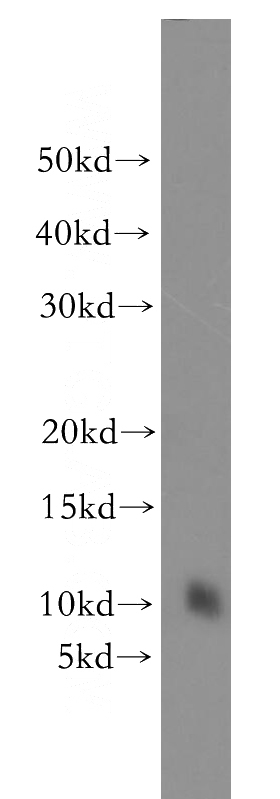 HEK-293 cells were subjected to SDS PAGE followed by western blot with Catalog No:110756(FXYD4 antibody) at dilution of 1:500