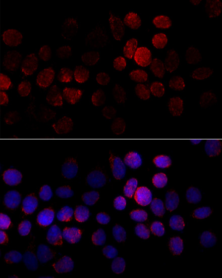 Immunofluorescence - CYP2J2 Polyclonal Antibody 