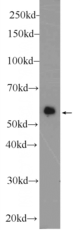 HepG2 cells were subjected to SDS PAGE followed by western blot with Catalog No:110072(DPP9 Antibody) at dilution of 1:600