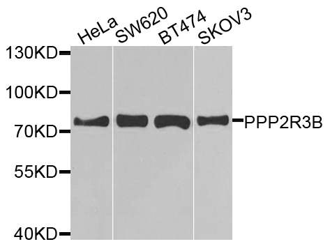 Western blot - PPP2R3B Polyclonal Antibody 