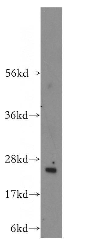 human lung tissue were subjected to SDS PAGE followed by western blot with Catalog No:114502(RABL3 antibody) at dilution of 1:300