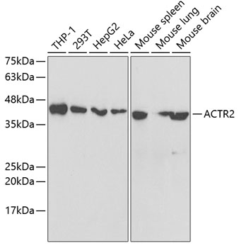 Western blot - ACTR2 Polyclonal Antibody 