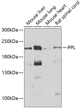 Western blot - PPL Polyclonal Antibody 