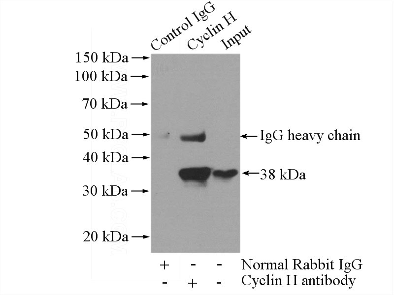 IP Result of anti-CCNH (IP:Catalog No:109668, 4ug; Detection:Catalog No:109668 1:1000) with HeLa cells lysate 1200ug.