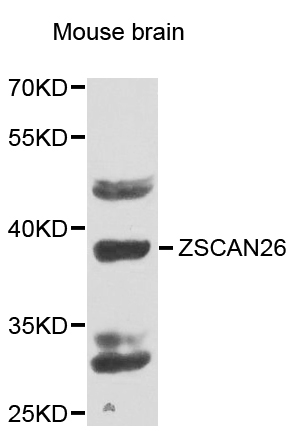 Western blot - ZSCAN26 Polyclonal Antibody 