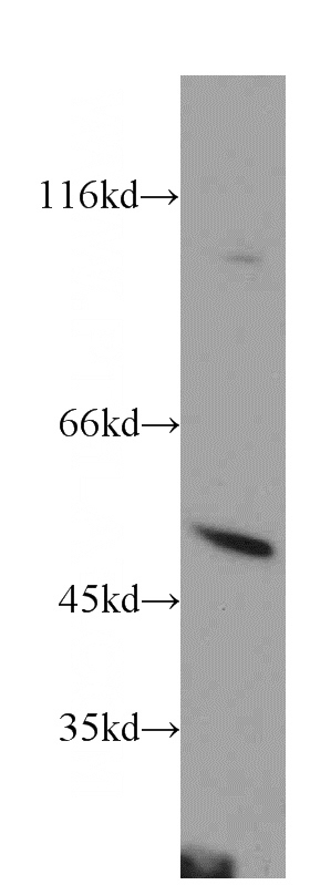 mouse thymus tissue were subjected to SDS PAGE followed by western blot with Catalog No:114255(PSTPIP1 antibody) at dilution of 1:300