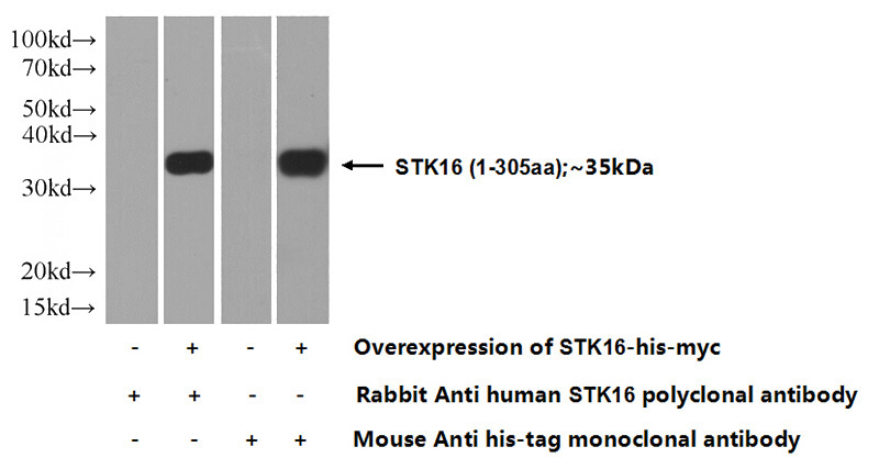 Transfected HEK-293 cells were subjected to SDS PAGE followed by western blot with Catalog No:115711(STK16 Antibody) at dilution of 1:1000