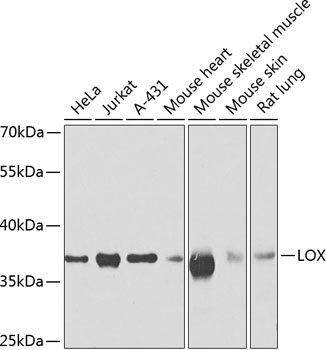 Western blot - LOX Polyclonal Antibody 