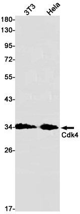 Western blot detection of Cdk4 in K562,Hela cell lysates using Cdk4 Rabbit pAb(1:1000 diluted).Predicted band size:34kDa.Observed band size:34kDa.