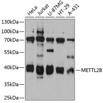 Western blot - METTL2B Polyclonal Antibody 