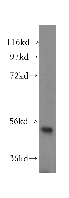 mouse uterus tissue were subjected to SDS PAGE followed by western blot with Catalog No:116396(TRMT11 antibody) at dilution of 1:400