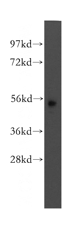 mouse pancreas tissue were subjected to SDS PAGE followed by western blot with Catalog No:112595(MEF2A antibody) at dilution of 1:400