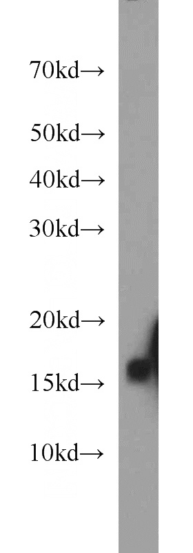 mouse skeletal muscle tissue were subjected to SDS PAGE followed by western blot with Catalog No:113075(NDUFB6 antibody) at dilution of 1:800