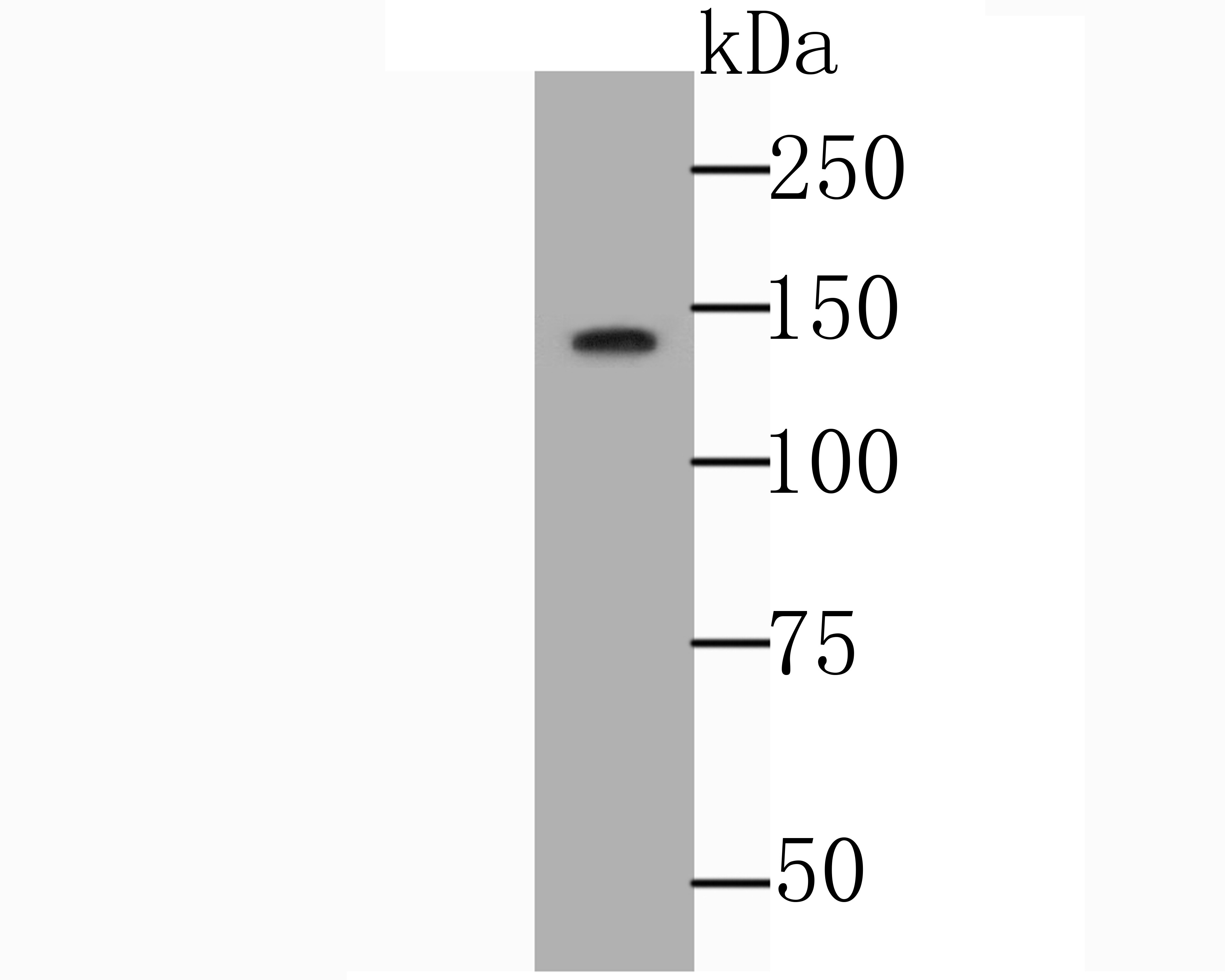 Fig1: Western blot analysis of NRCAM on SH-SY5Y cell lysate using anti-NRCAM antibody at 1/1,000 dilution.