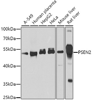 Western blot - PSEN2 Polyclonal Antibody 