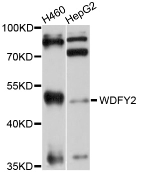Western blot - WDFY2 Polyclonal Antibody 