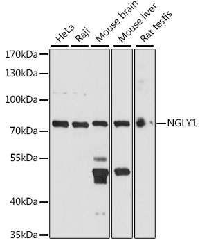 Western blot - NGLY1 Polyclonal Antibody 