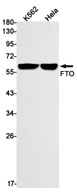 Western blot detection of FTO in K562,Hela cell lysates using FTO Rabbit mAb(1:1000 diluted).Predicted band size:58kDa.Observed band size:58kDa.
