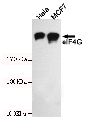 Western blot analysis of extracts from Hela and MCF7 cells using eIF4G (Ab-1232) rabbit pAb (dilution 1:1000).Predicted band size:220KDa.Observed band size:220KDa.