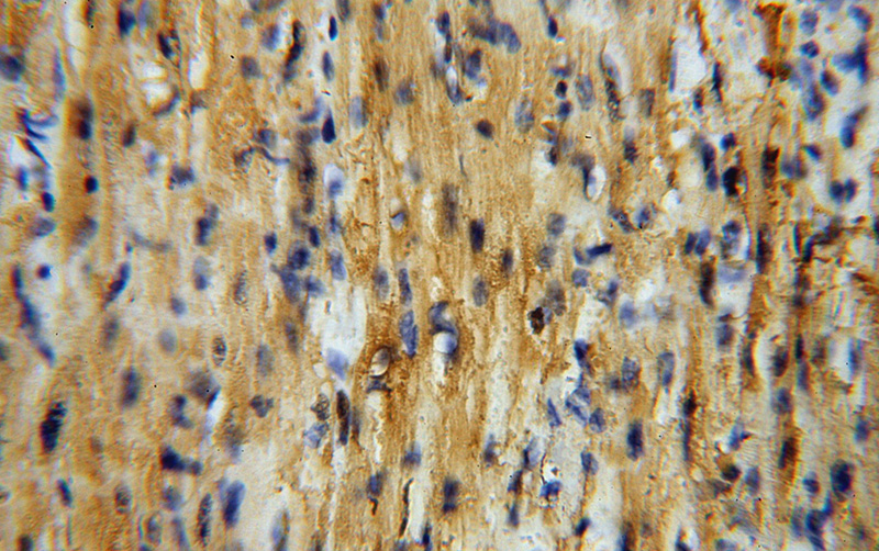 Immunohistochemical of paraffin-embedded human heart using Catalog No:111188(GSTM5 antibody) at dilution of 1:50 (under 40x lens)