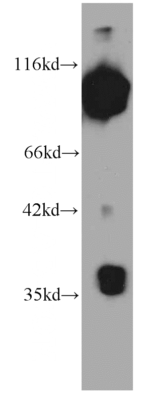 HepG2 cells were subjected to SDS PAGE followed by western blot with Catalog No:107428(MMS19 antibody) at dilution of 1:1000