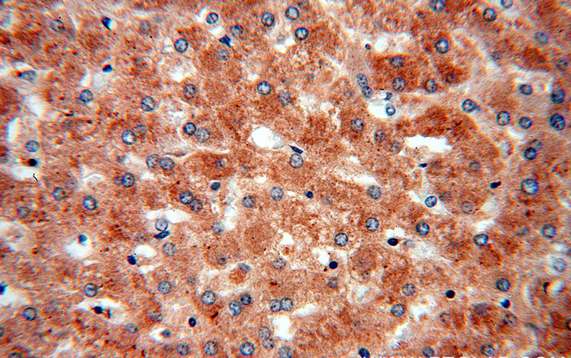 Immunohistochemical of paraffin-embedded human liver using Catalog No:114262(PTCH1 antibody) at dilution of 1:50 (under 40x lens)