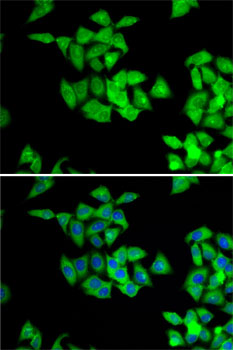 Immunofluorescence - NMT2 Polyclonal Antibody 