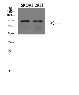 Fig1:; Western blot analysis of MOUSE-BRAIN lysate, antibody was diluted at 1000. Secondary antibody（catalog#：HA1001) was diluted at 1:20000