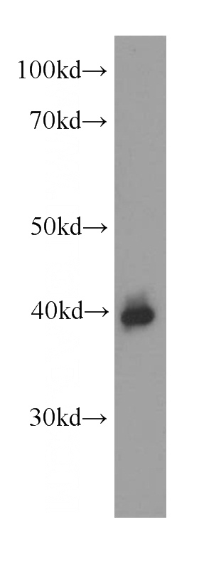 human plasma tissue were subjected to SDS PAGE followed by western blot with Catalog No:107074(AZGP1 Antibody) at dilution of 1:1000