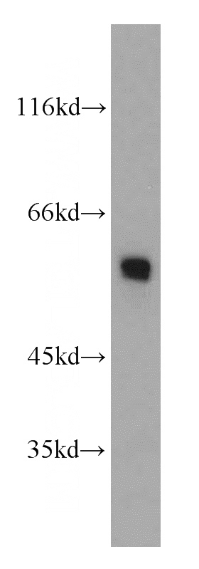 mouse heart tissue were subjected to SDS PAGE followed by western blot with Catalog No:110656(FGB antibody) at dilution of 1:1000