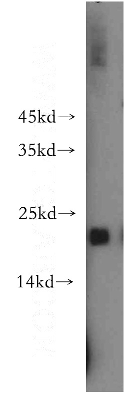 HepG2 cells were subjected to SDS PAGE followed by western blot with Catalog No:110170(EID1 antibody) at dilution of 1:300