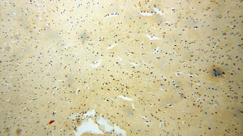 Immunohistochemical of paraffin-embedded human brain using Catalog No:114475(RASGEF1A antibody) at dilution of 1:100 (under 10x lens)