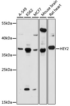 Western blot - HEY2 Polyclonal Antibody 