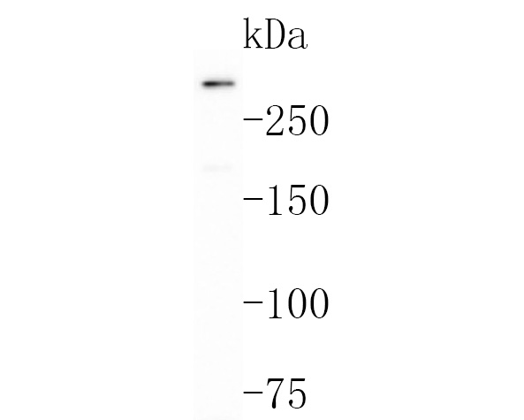 Fig1:; Western blot analysis of Versican on Hela cell lysates. Proteins were transferred to a PVDF membrane and blocked with 5% BSA in PBS for 1 hour at room temperature. The primary antibody ( 1/500) was used in 5% BSA at room temperature for 2 hours. Goat Anti-Rabbit IgG - HRP Secondary Antibody (HA1001) at 1:200,000 dilution was used for 1 hour at room temperature.