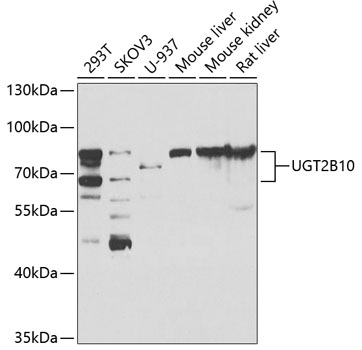 Western blot - UGT2B10 Polyclonal Antibody 