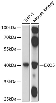Western blot - EXO5 Polyclonal Antibody 