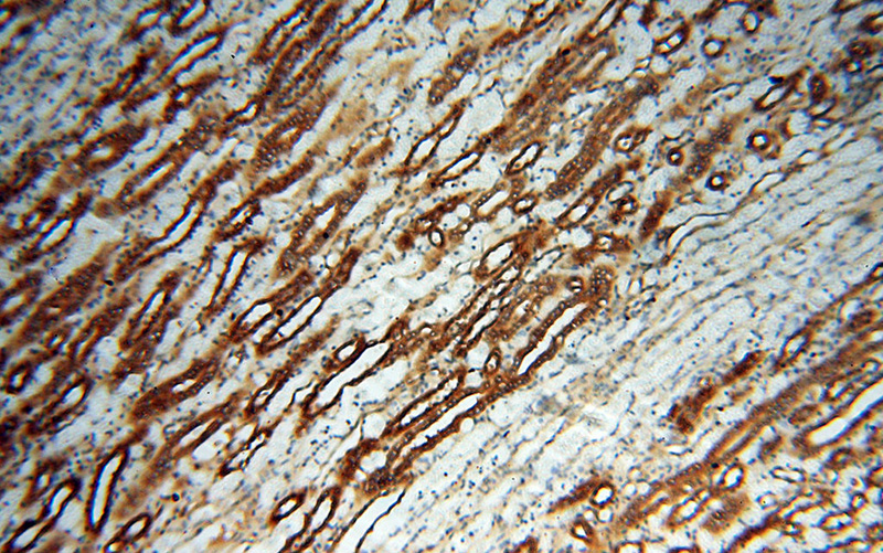 Immunohistochemical of paraffin-embedded human kidney using Catalog No:112705(MMP28 antibody) at dilution of 1:100 (under 10x lens)
