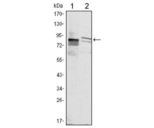 Fig1: Western blot analysis of KLHL11 on Hela and MCF-7 cell lysate using anti-KLHL11 antibody at 1/1,000 dilution.