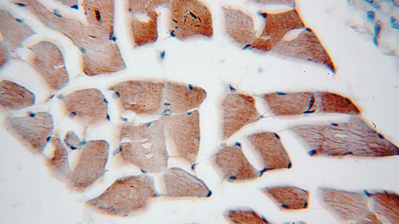 Immunohistochemical of paraffin-embedded human skeletal muscle using Catalog No:116705(VAMP2 antibody) at dilution of 1:50 (under 40x lens)