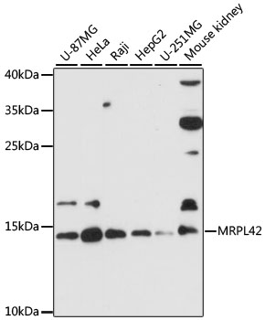 Western blot - MRPL42 Polyclonal Antibody 