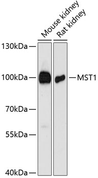 Western blot - MST1 Polyclonal Antibody 