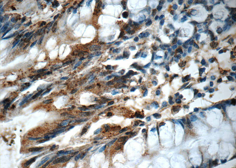 Immunohistochemistry of paraffin-embedded human colon tissue slide using Catalog No:109108(CDC42SE2 Antibody) at dilution of 1:50 (under 40x lens)