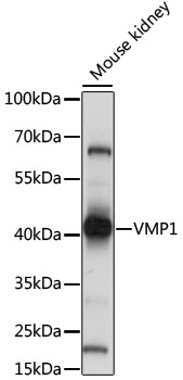Western blot - VMP1 Polyclonal Antibody 