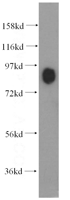 mouse brain tissue were subjected to SDS PAGE followed by western blot with Catalog No:112449(Marcks antibody) at dilution of 1:2000
