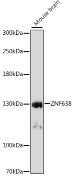 Western blot - ZNF638 Polyclonal Antibody 