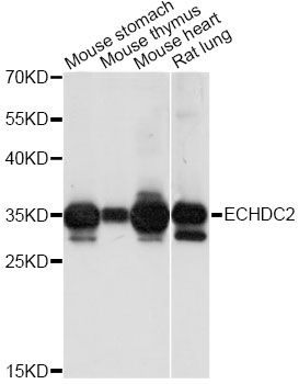 Western blot - ECHDC2 Polyclonal Antibody 